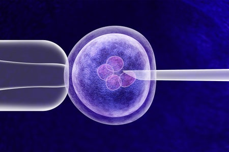 In vitro fertilization (IVF)