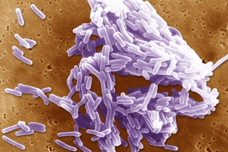 Scan electron micrograph of Listeria monocytogenes